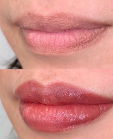 Consultation before lip blush treatment in London clinic.